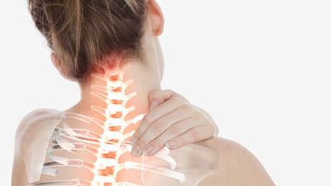 Остеохондроз шейного отдела позвоночника